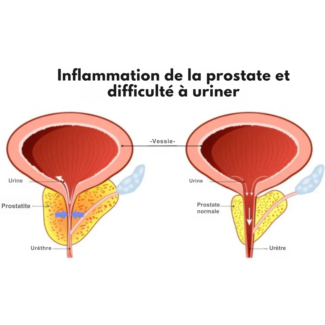 2 boite Capsules pour hémorroïdes à base de plantes